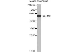 Western blot analysis of extracts of mouse esophagus, using COX10 Antibody (ABIN2561967) at 1:1000 dilution. (COX10 抗体)