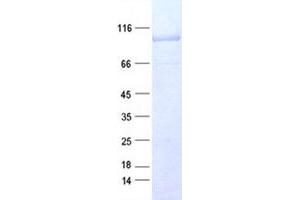 Western Blotting (WB) image for Catenin (Cadherin-Associated Protein), beta 1, 88kDa (CTNNB1) protein (DYKDDDDK Tag) (ABIN2713222)