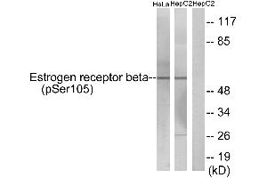 Western blot analysis of extracts from HeLa cells and HepG2 cells, using Estrogen Receptor-β (Phospho-Ser105) antibody. (ESR2 抗体  (pSer105))