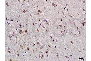 Formalin-fixed and paraffin embedded: rat brain tissue labeled with Anti-Nogo-R Polyclonal Antibody (ABIN725420), Unconjugated at 1:200 followed by conjugation to the secondary antibody and DAB staining (RTN4R 抗体  (AA 151-350))