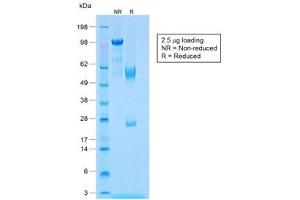 SDS-PAGE analysis of purified, BSA-free recombinant Calponin antibody (clone CNN1/1408R) as confirmation of integrity and purity. (Recombinant Calponin 抗体)
