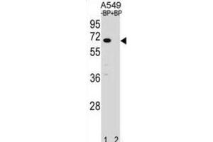 Western Blotting (WB) image for anti-Ankyrin Repeat and SOCS Box-Containing 3 (ASB3) antibody (ABIN2998967) (ASB3 抗体)