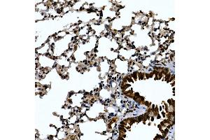 Immunohistochemistry (IHC) image for anti-Zinc Finger Protein 384 (ZNF384) (AA 1-180) antibody (ABIN7271478)