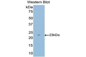 Western Blotting (WB) image for anti-Fibulin 1 (FBLN1) (AA 399-578) antibody (ABIN1175705) (Fibulin 1 抗体  (AA 399-578))
