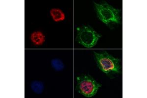 ABIN6262321 and ABIN6268789 staining Hela by IF/ICC.