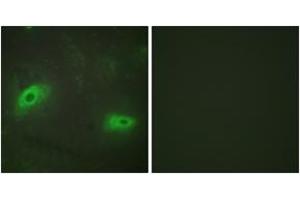 Immunofluorescence analysis of HeLa cells, using TNFSF9 Antibody. (TNFSF9 抗体  (AA 31-80))