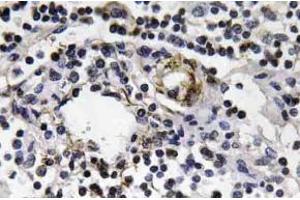 Immunohistochemistry (IHC) analyzes of IFN-gamma antibody in paraffin-embedded human lymph node tissue. (Interferon gamma 抗体)