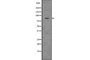 Western blot analysis Nephrin using mouse kidney tissue lysates (Nephrin 抗体)