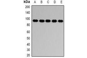 Western blot analysis of PTP epsilon expression in HL60 (A), SW620 (B), mouse brain (C), mouse spleen (D), rat lung (E) whole cell lysates. (PTPRE 抗体)