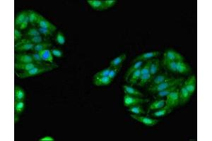 Immunofluorescent analysis of HepG2 cells using ABIN7154159 at dilution of 1:100 and Alexa Fluor 488-congugated AffiniPure Goat Anti-Rabbit IgG(H+L) (GPD1 抗体  (AA 1-349))