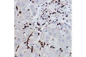 Immunohistochemistry of paraffin-embedded human liver using L-Plastin/LCP1 Rabbit mAb (ABIN7268317) at dilution of 1:100 (40x lens). (LCP1 抗体)