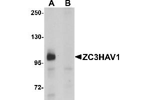 Western Blotting (WB) image for anti-Zinc Finger CCCH-Type, Antiviral 1 (ZC3HAV1) (C-Term) antibody (ABIN1030817) (ZC3HAV1 抗体  (C-Term))