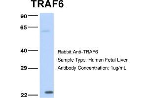 Host: Rabbit Target Name: TRAF6 Sample Type: Human Fetal Liver Antibody Dilution: 1. (TRAF6 抗体  (Middle Region))