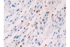 Immunohistochemistry (IHC) image for anti-Protein S (PROS) (AA 481-667) antibody (ABIN7438076)