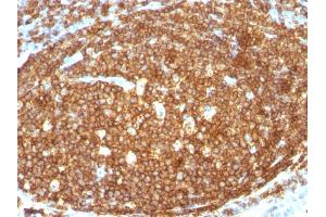 Immunohistochemistry (IHC) image for anti-Protein tyrosine Phosphatase, Receptor Type, C (PTPRC) antibody (ABIN6940471)