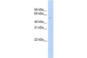 Human MCF-7; WB Suggested Anti-GAS8 Antibody Titration: 0. (GAS8 抗体  (N-Term))