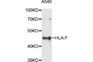 Western blot analysis of extracts of A-549 cells, using HLA-F antibody (ABIN5997910) at 1/1000 dilution. (HLA-F 抗体)