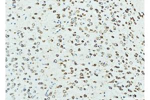 IHC analysis of RPL23 using anti-RPL23 antibody (ABIN7599808). (RPL23 抗体  (AA 12-136))