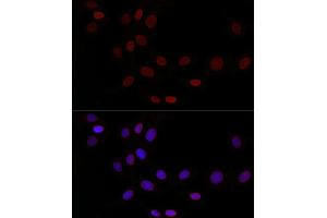 Immunofluorescence analysis of NIH/3T3 cells using TMPO Rabbit pAb (ABIN3016206, ABIN3016207, ABIN3016208, ABIN1683056 and ABIN1683057) at dilution of 1:50 (40x lens).