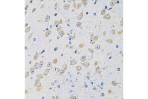 Immunohistochemistry of paraffin-embedded mouse brain using MSRA antibody (ABIN5973791) at dilution of 1/100 (40x lens). (MSRA 抗体)