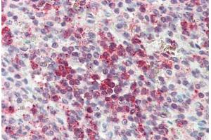 Anti-CYSLTR2 / CYSLT2 antibody  ABIN1048490 IHC staining of human spleen. (CasLTR2 抗体  (C-Term))