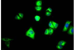Immunofluorescence staining of Hela Cells with ABIN7127769 at 1:50, counter-stained with DAPI. (Recombinant PKM 抗体)