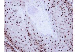 IHC-P Image Immunohistochemical analysis of paraffin-embedded Cal27 Xenograft, using GABP-beta1, antibody at 1:100 dilution. (GABPB1 抗体  (Center))