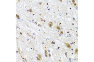 Immunohistochemistry of paraffin-embedded rat brain using HDAC4 antibody (ABIN4903045) at dilution of 1:100 (40x lens). (TUBB 抗体)