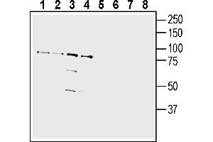 Western blot analysis of human Jurkat T-cell leukemia cell line lysate (lanes 1 and 5), human Burkitt's lymphoma (Daudi) cell line lysate (lanes 2 and 6), human normal skin fibroblast Malme-3 cell line lysate (lanes 3 and 7) and Human prostate carcinoma LN-CaP cell line lysate (lanes 4 and 8):1-4. (IGSF8 抗体  (Extracellular))