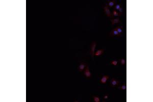 anti-CD226 (CD226) antibody
