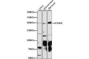 Western blot analysis of extracts of various cell lines, using KDM5B antibody  at 1:1000 dilution.