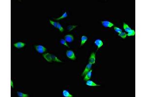 Immunofluorescent analysis of Hela cells using ABIN7156464 at dilution of 1:100 and Alexa Fluor 488-congugated AffiniPure Goat Anti-Rabbit IgG(H+L) (CD11b 抗体  (AA 46-150))