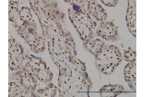 Image no. 1 for anti-SMC6 Structural Maintenance of Chromosomes 6-Like 1 (SMC6) (AA 1-110) antibody (ABIN599304) (SMC6 抗体  (AA 1-110))