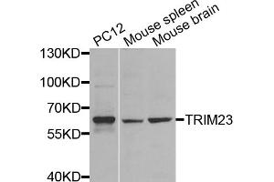 Western blot analysis of extracts of various cell lines, using TRIM23 antibody (ABIN5974665) at 1/1000 dilution. (TRIM23 抗体)