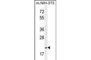 anti-Transcription Elongation Factor A (SII)-Like 3 (TCEAL3) (AA 15-43), (N-Term) antibody