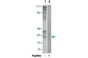 Western blot analysis of extracts from K-562 cells, using CIB3 polyclonal antibody . (CIB3 抗体  (C-Term))
