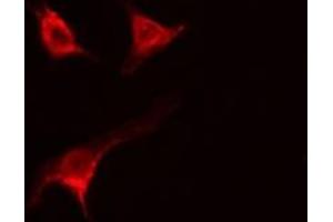 ABIN6277345 staining  MCF7 cells by IF/ICC. (USO1 抗体  (C-Term))