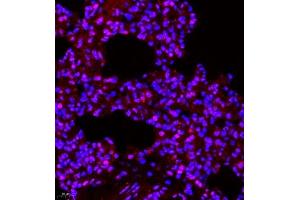 Immunofluorescence (Paraffin-embedded Sections) (IF (p)) image for anti-Suppressor of Variegation 3-9 Homolog 1 (Drosophila) (SUV39H1) antibody (ABIN7075770)