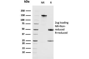 SDS-PAGE Analysis Purified MAGEA4 Mouse Monoclonal Antibody (CPTC-MAGEA4-1). (MAGEA4 抗体)