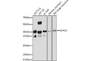 Western blot analysis of extracts of various cell lines, using GP Rabbit mAb (ABIN1682863, ABIN3017875, ABIN3017876 and ABIN7101532) at 1:1000 dilution. (GPA33 抗体)