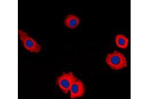 Immunofluorescent analysis of MUC16 staining in HuvEc cells. (MUC16 抗体  (Center))