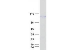 Western Blotting (WB) image for Mannan-Binding Lectin Serine Peptidase 1 (MASP1) (Transcript Variant 2) protein (Myc-DYKDDDDK Tag) (ABIN2725533)