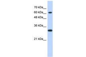 Image no. 1 for anti-Ets2 Repressor Factor (ERF) (AA 371-420) antibody (ABIN6740291) (ERF 抗体  (AA 371-420))