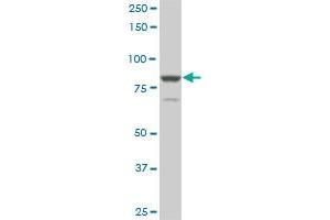 TACC3 monoclonal antibody (M02), clone 6C4. (TACC3 抗体  (AA 1-100))