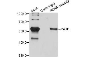 Immunoprecipitation analysis of 200 μg extracts of SW620 cells using 3 μg P4HB antibody (ABIN5970266). (P4HB 抗体)