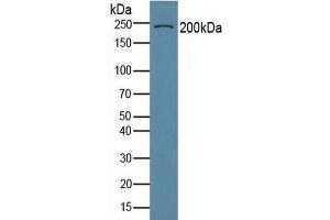 Detection of COL6a3 in Human Serum using Polyclonal Antibody to Collagen Type VI Alpha 3 (COL6a3) (COL6a3 抗体  (AA 463-624))