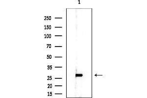 Western blot analysis of lysates from EC304 cells, using RPL10A Mouse Monoclonal Antibody at 1/1000 dilution.