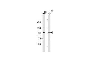 All lanes : Anti-NSUN2 Antibody (Center) at 1:1000 dilution Lane 1: Hela whole cell lysate Lane 2: Jurkat whole cell lysate Lysates/proteins at 20 μg per lane. (NSUN2 抗体  (AA 423-451))