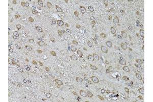 Immunohistochemistry of paraffin-embedded mouse brain using SNAI1 antibody. (SNAIL 抗体  (AA 1-264))