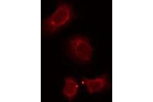 anti-Olfactory Receptor, Family 7, Subfamily E, Member 5 Pseudogene (OR7E5P) antibody
